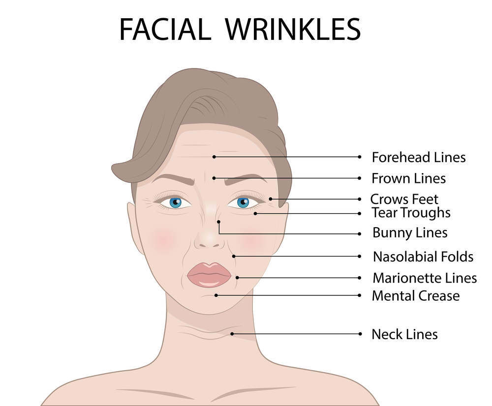 graphic of face showing areas where wrinkles appear