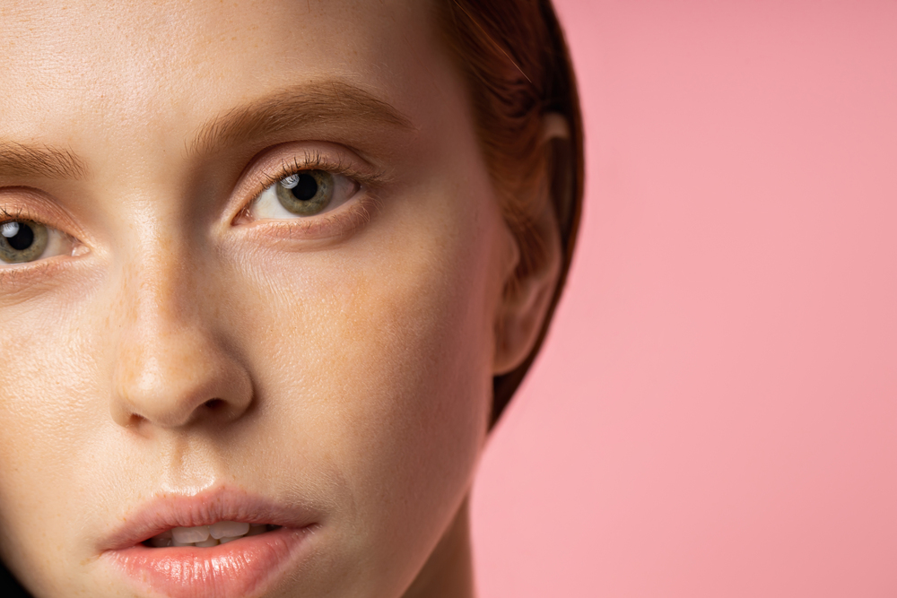 redhead caucasian young woman with botox