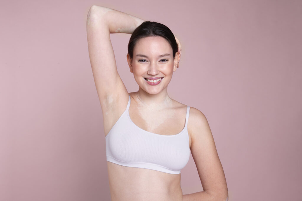 woman smiling showing armpit